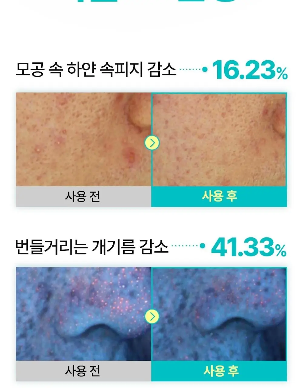 [수딩진정] 넘버즈인 1번 판토텐산 액티브 수딩크림 80ml 1+1 기획 상세페이지 23